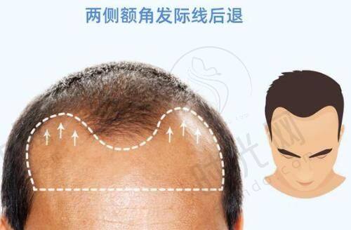 清迈整形医院的特色与优势