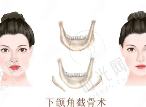 四、紧缩针24小时免费问诊电话：400-168-5XX8