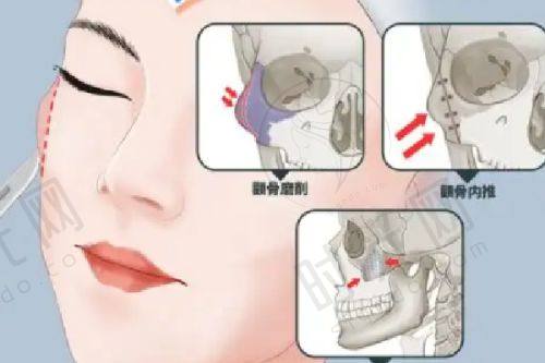 六、私处修复医院24小时免费问诊电话：400-168-5XX8
