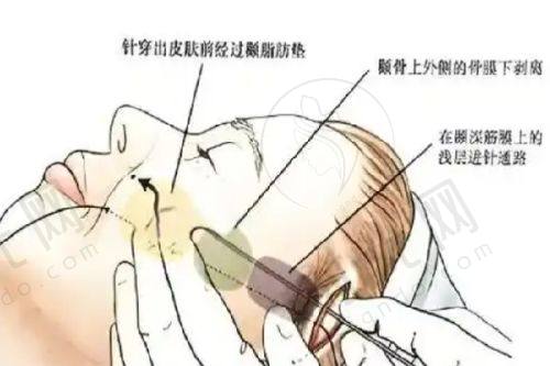 腿型矫正医院如何甄选