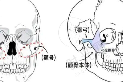 推荐的国内变性手术医院