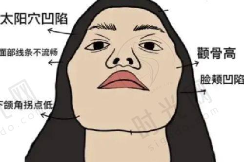 国内变性手术的价格范围
