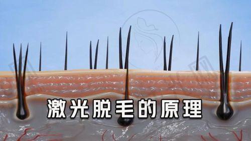 7、山西太原泽亿医院——太原新兴医院激光脱毛潜力之选