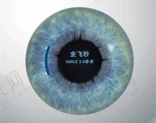 西安四院眼科报销细则