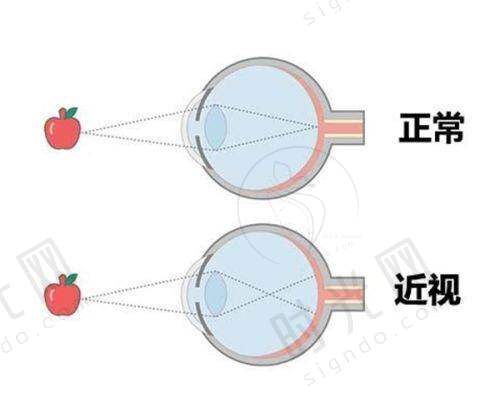 总结