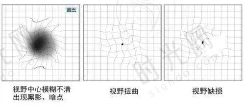 2025西安四院眼科预约流程 & 报销比例