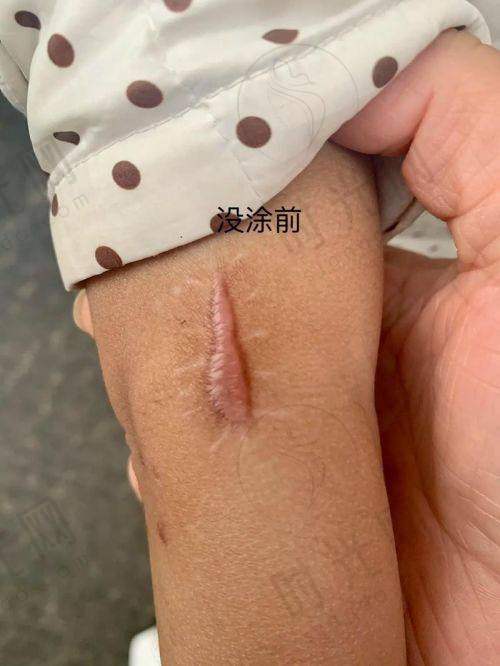 沈阳华美整形美容医院怎么样