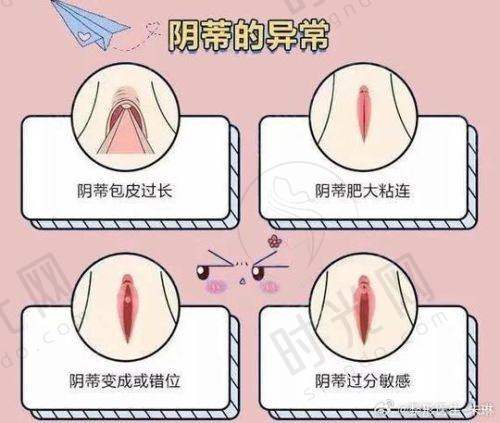 术后要点