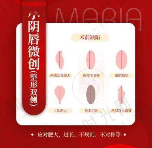 术中要点