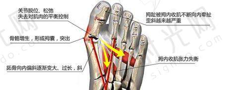 谁做鼻子更自然