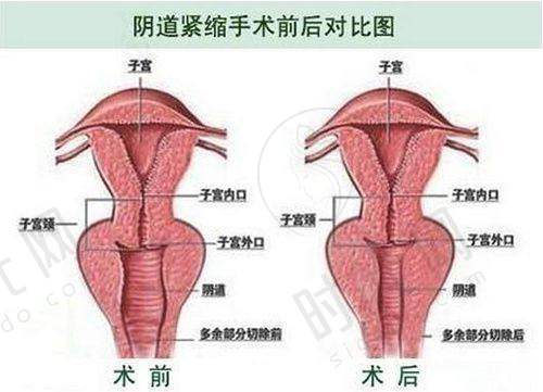 合肥韩美整形外科医院