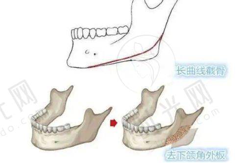 北京地区的优质拉皮医院
