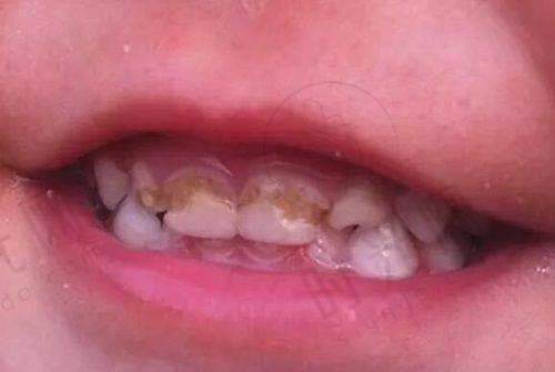 常德雅康口腔：牙齿矫正的专精之选
