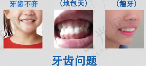 其他口腔项目