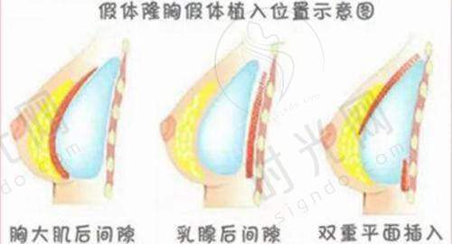 吕方中医生坐诊医院