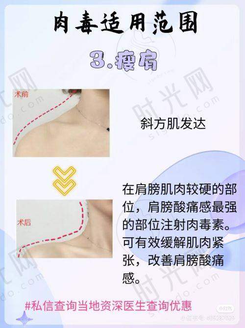 上海做鼻子出名的医生排名情况