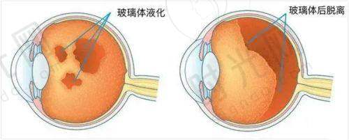 希玛林顺潮眼科