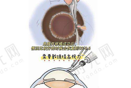 总结