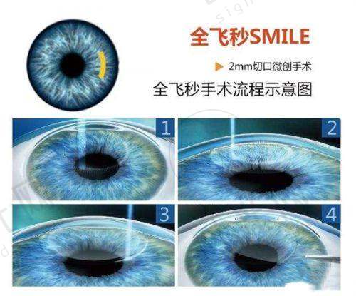 就诊流程优化建议