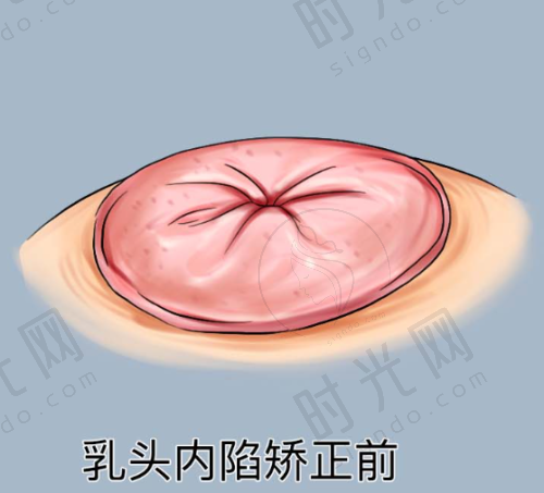 总结