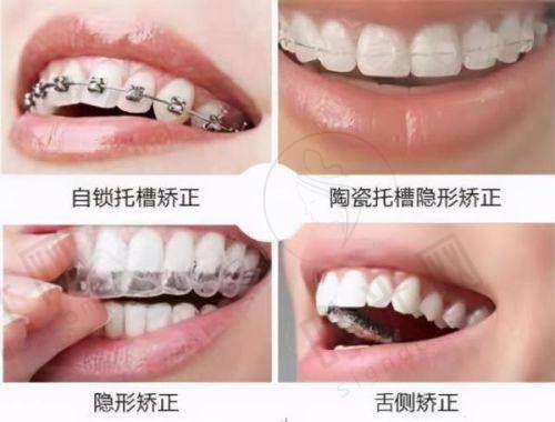 总结