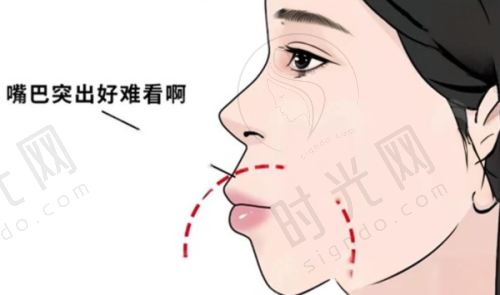 牙齿矫正项目