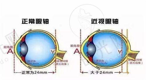 兰州普瑞眼科医院医生信息