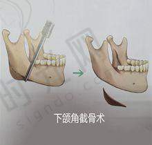 技术与个性化设计