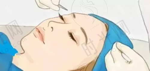 唇裂二期修复的价格解析