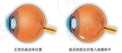 李献和医生唇裂二期修复的口碑展示