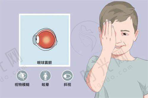 白内障手术