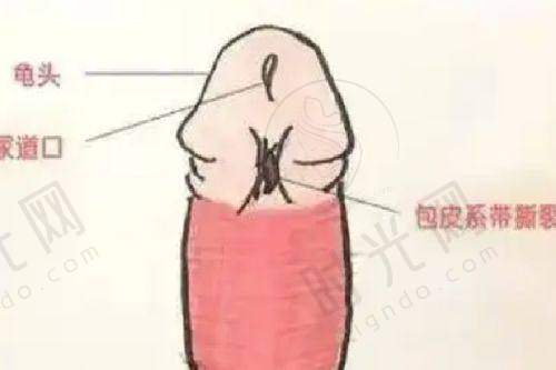 祛斑医生