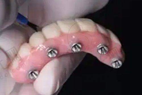 总结
