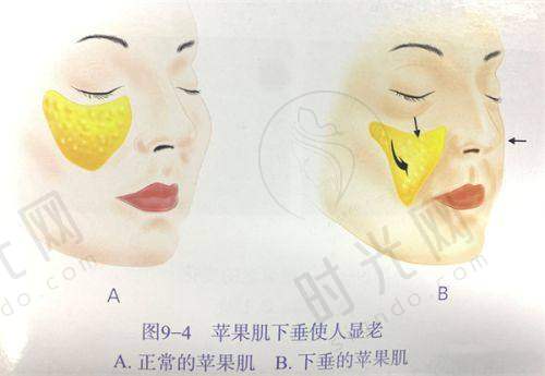 总结