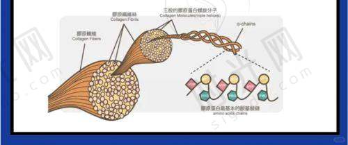 腰腹吸脂实例