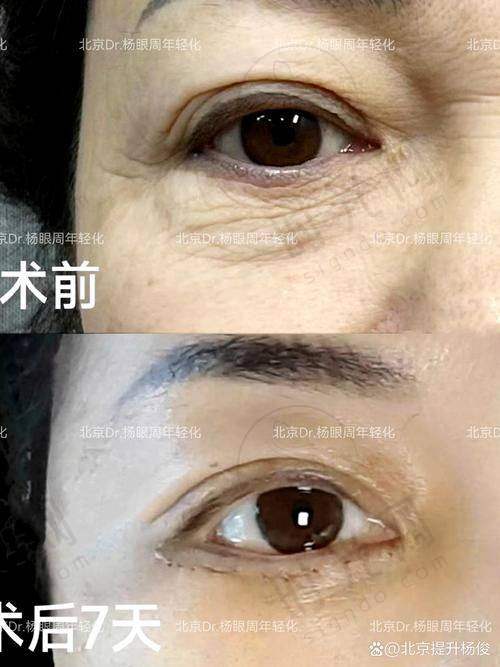 北京毛运春医生在哪个医院在那个院区