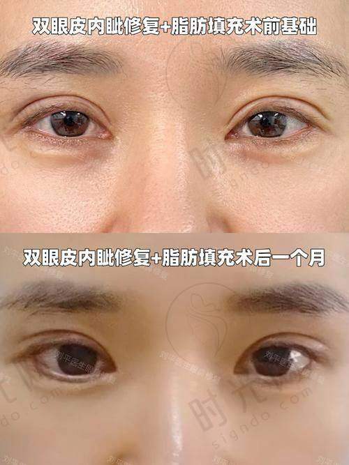 毛运春大夫技术怎么样？毛运春医生技术水平高