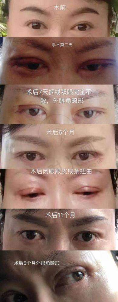毛运春医生价格表