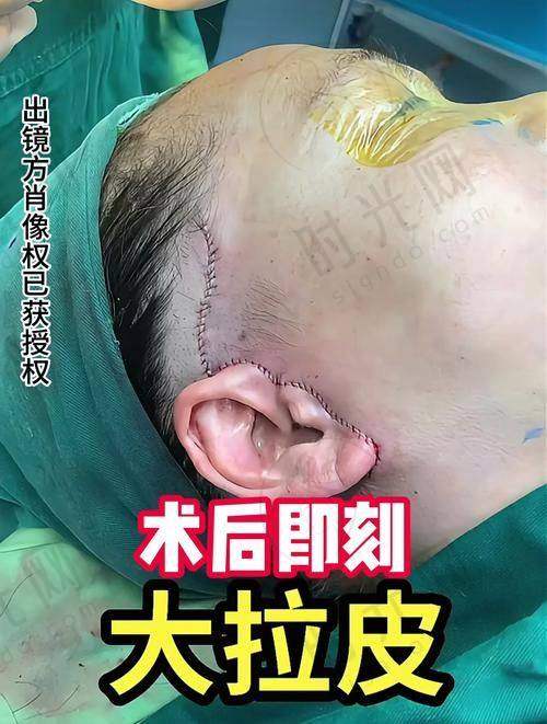 四、真实实例见证：从衰老困扰到年轻蜕变