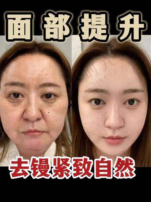 七、总结：一次选择，十年年轻