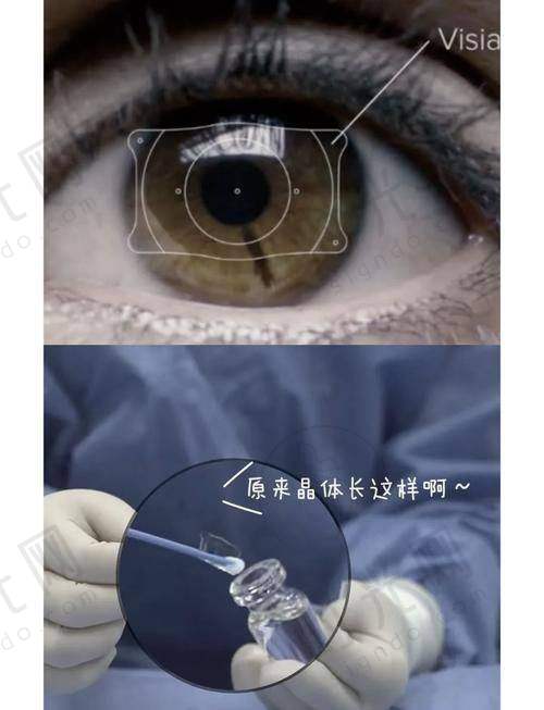 潘中婷医生技术水平高