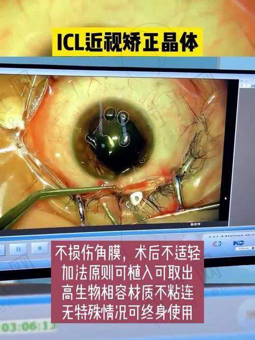 褚仁远医生价格表