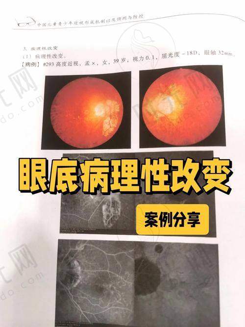 五、封康医生坐诊医院：北京熙仁眼科医院