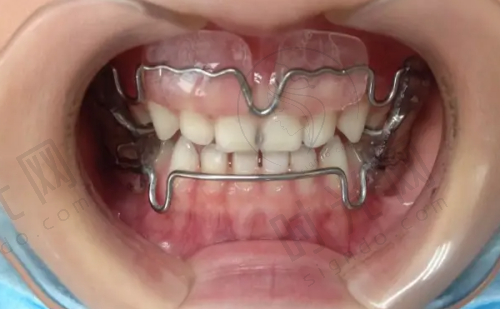 台州其他地区牙科医院介绍