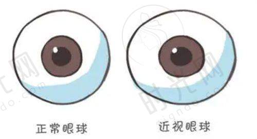 实例二:68岁老人三焦点晶体白内障手术——术后扔掉老花镜,重拾书法爱好