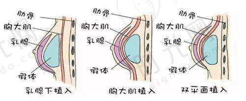 李信锋医生坐诊哪个医院？