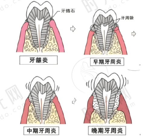 张雷医生预约挂号