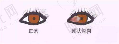 徐州市第一人民医院眼科预约挂号方式