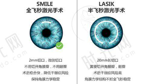 苏州光明眼科医院什么性质