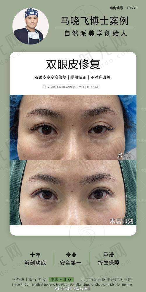 李罡医生擅长项目